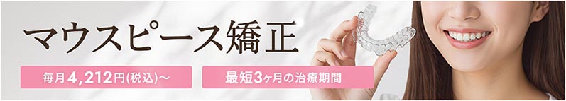 マウスピース矯正 お試しOK！1回1万円 最短5ヶ月の治療期間