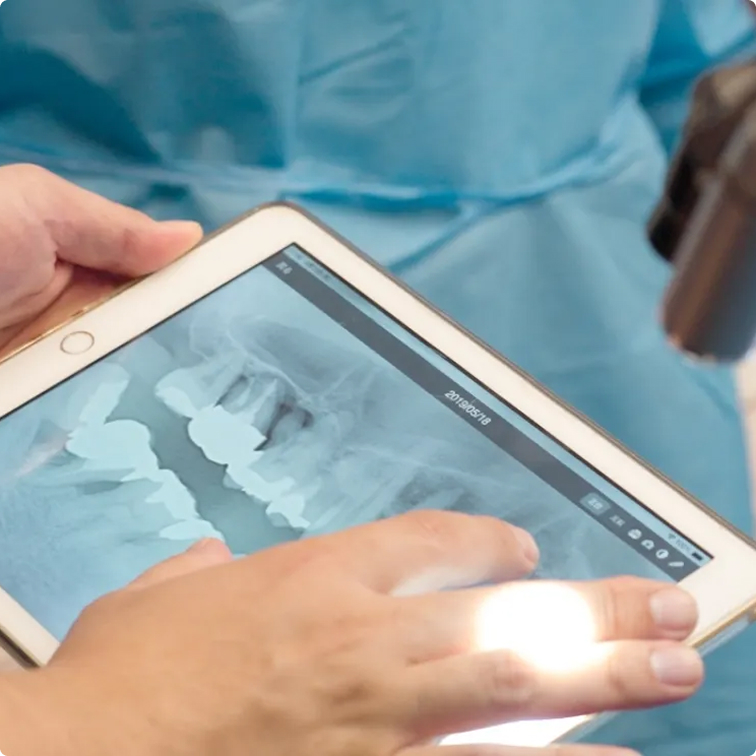 歯科用CTやデジタルシミュレーション